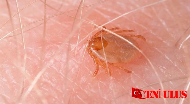 Kırım Kongo Kanamalı Ateşi Belirtileri